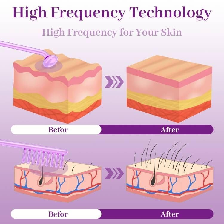 Facial Massager High Frequency Facial Device Wand - TUMAKOU Violet High Frequency Skin Face Machine with 4 Purple Tubes