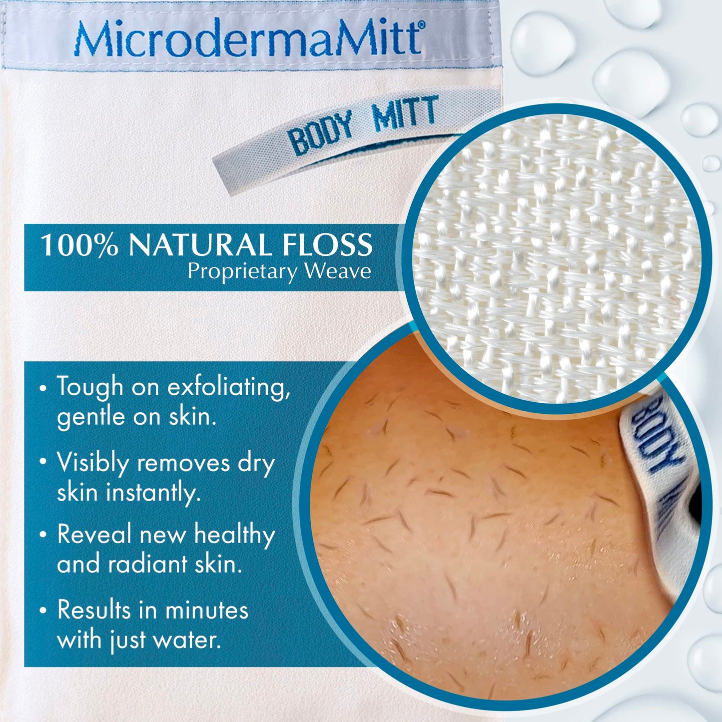 Microdermamitt Deep Exfoliating Mitt Bath Glove Mitten for Body Scrub - Best Dry Skin Treatment, - Remove Dead Skin, Keratosis Pilaris Bumps Instantly