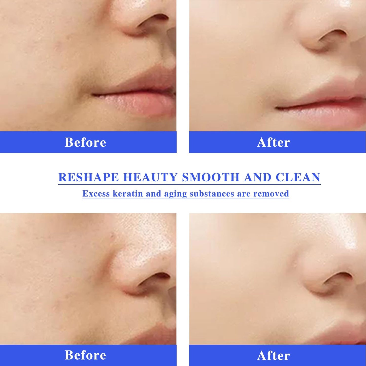 Aqua Peeling Solution for SPA Salon, 3 Bottle 400ml Skin Care Aqua Peel Serum, Small Bubble Solution, Hydro Facial Machine Solution for Cleaning Face