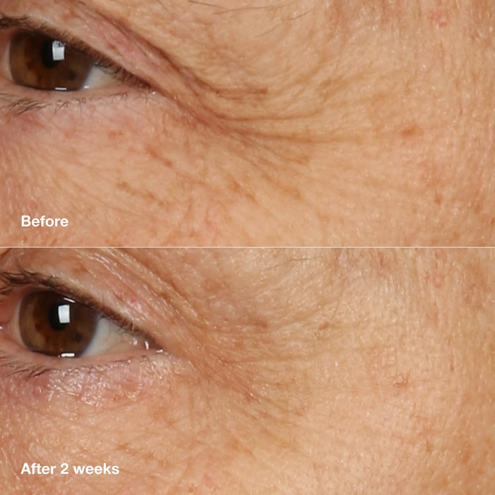 Clinique Smart Clinical Repair Overnight Recovery Cream + Mask