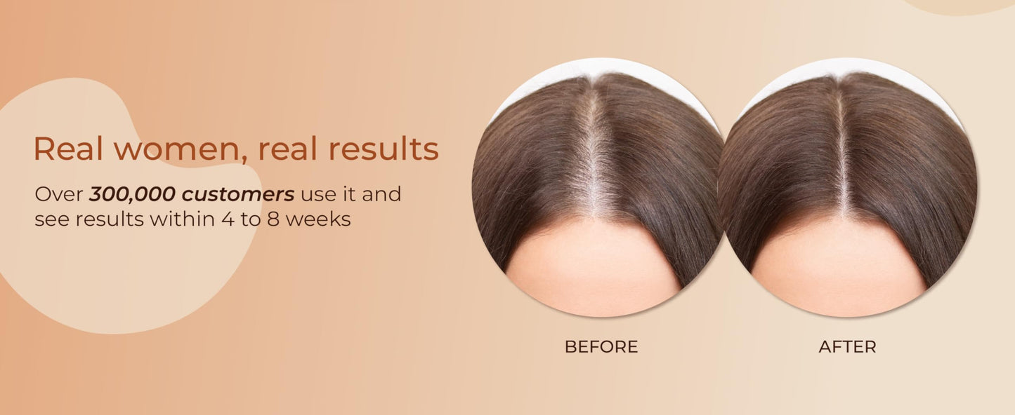 Abera Hair Serum – Nourishing & Thickening with Biotin & Castor Oil