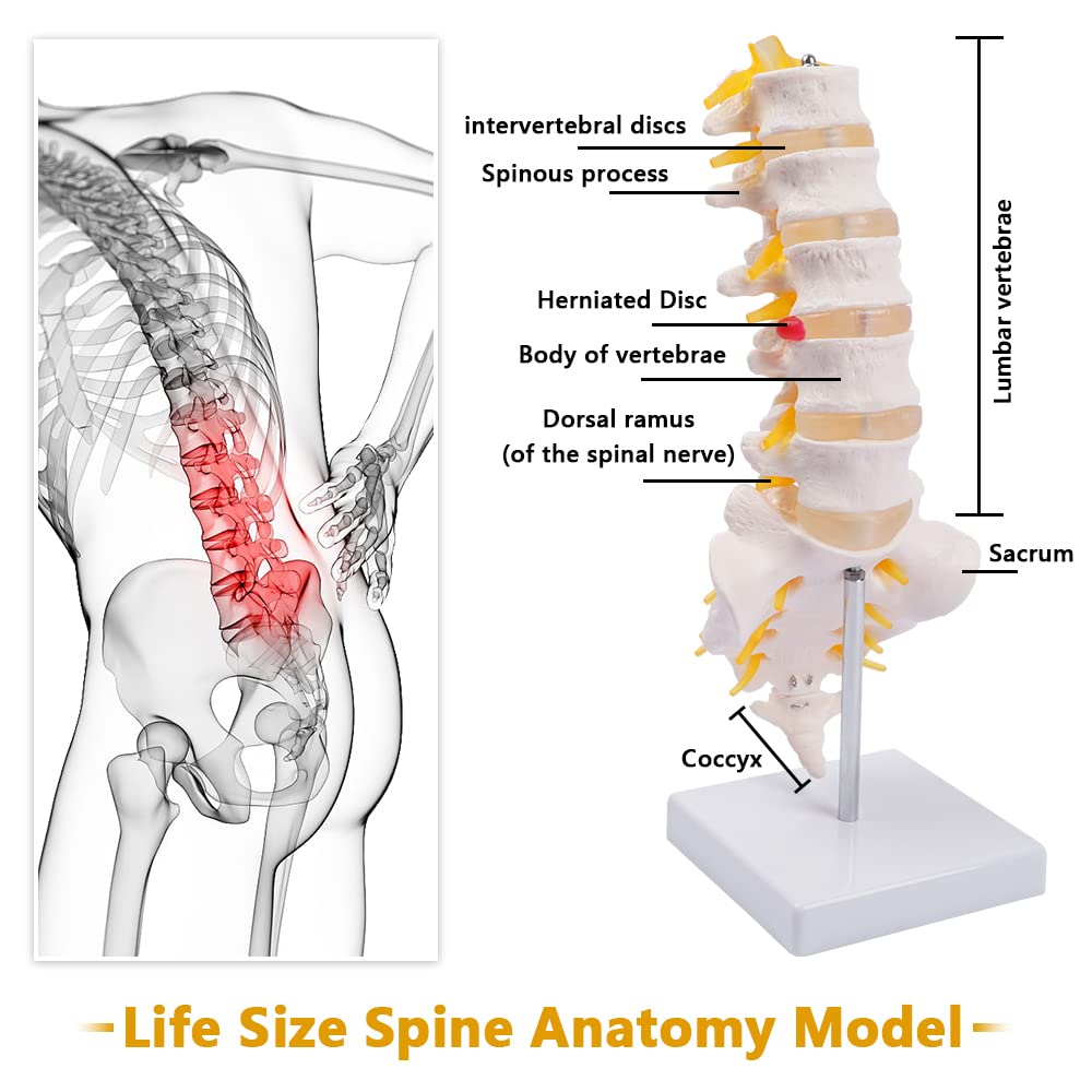 Lumbar Spine Model - Life Size Human Lumbar Vertebrae Anatomy Model with Sacrum and Spinal Nerves Medical Chiropractor Medical Student Study Teaching Demonstration