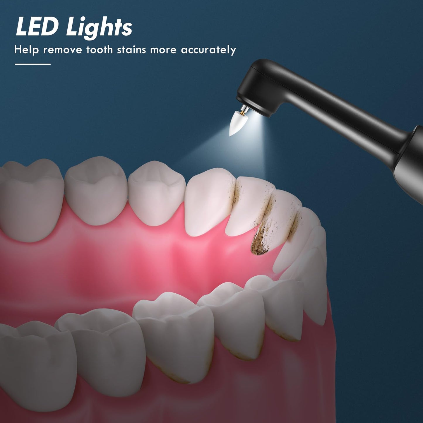 Barlisam Tooth Polisher, Rechargeable Teeth Polisher for Teeth Cleaning, Polishing and Whitening, Electric Dental Polisher Kit with 5 Multifunctional Heads, 5 Speed Modes, and IPX6 Waterproof