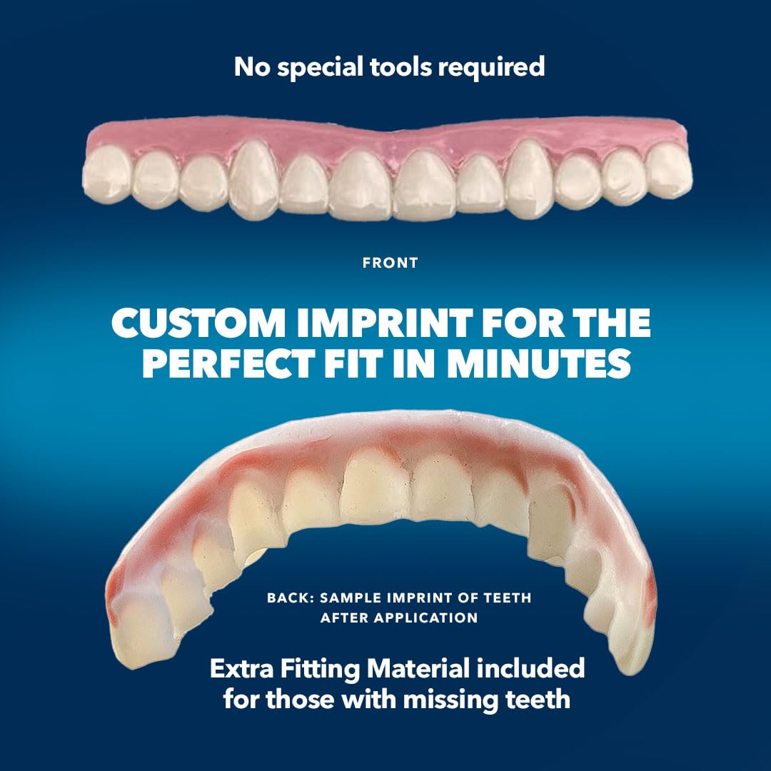 Imako Premium Cosmetic Uppers - 2 Pack - Large, Natural White - DIY Smile Makeover - Made in USA