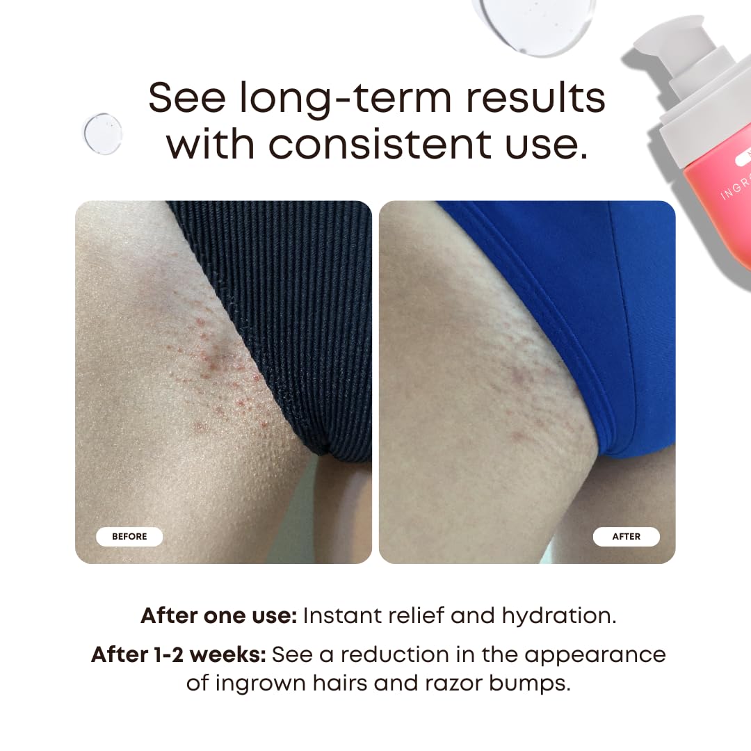Bushbalm Ingrown Hair and Razor Bumps Routine - Moisturize and Soothe After Shave Skincare for Sensitive Areas - Includes Ingrown Hair Oil (30 ml) and Exfoliating Scrub (236 ml) - Watermelon Sugar