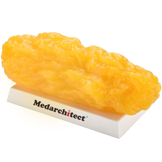 Authentic Human Body Fat Replica, Keep Fit & Weight Loss Motivation & Reminder, Human Fatty Tissue Demonstration Model for Nutritionist, Anatomical Science Course for Medical Student (5 lb)