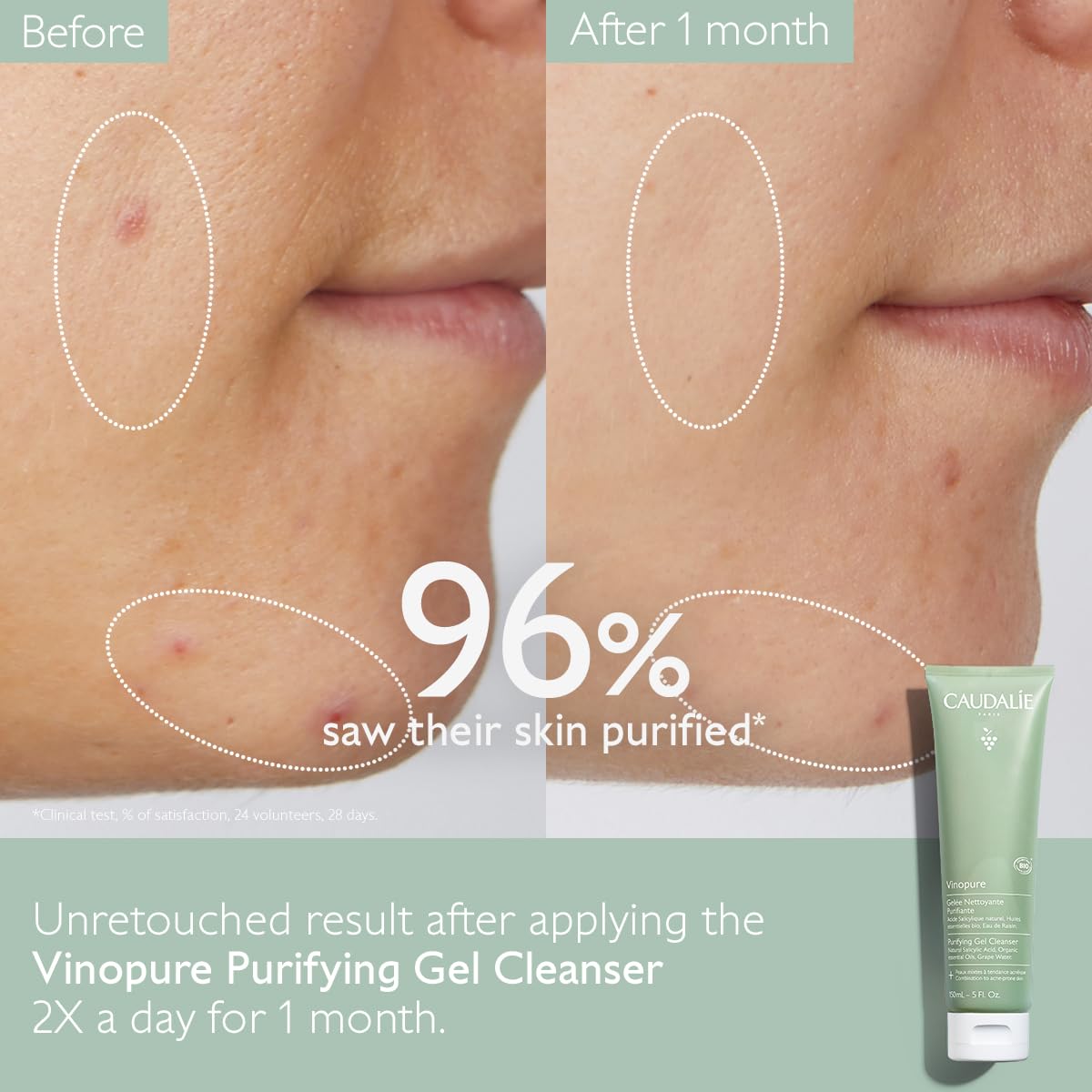 Caudalie Vinopure Purifying Gel Cleanser - 150 mL