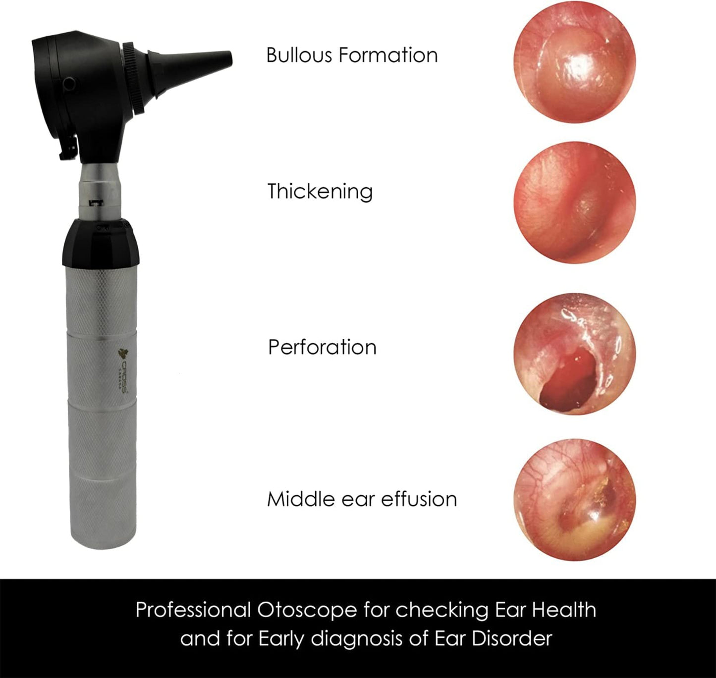 Cross Canada Physician LED Otoscope Diagnostic Set – Professional Otoscope for Physician, Medical Student, Nursing Student, Doctor, Nurse (Chrome)