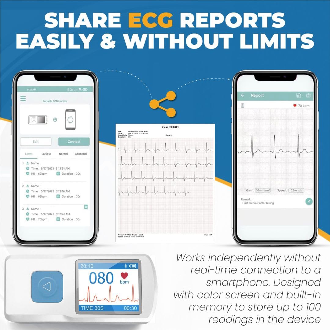 BEC Portable ECG Monitor - Electrocardiograph Monitors in Less Than 30 Seconds, no Need for a Smartphone, All Measurements are Done on Device