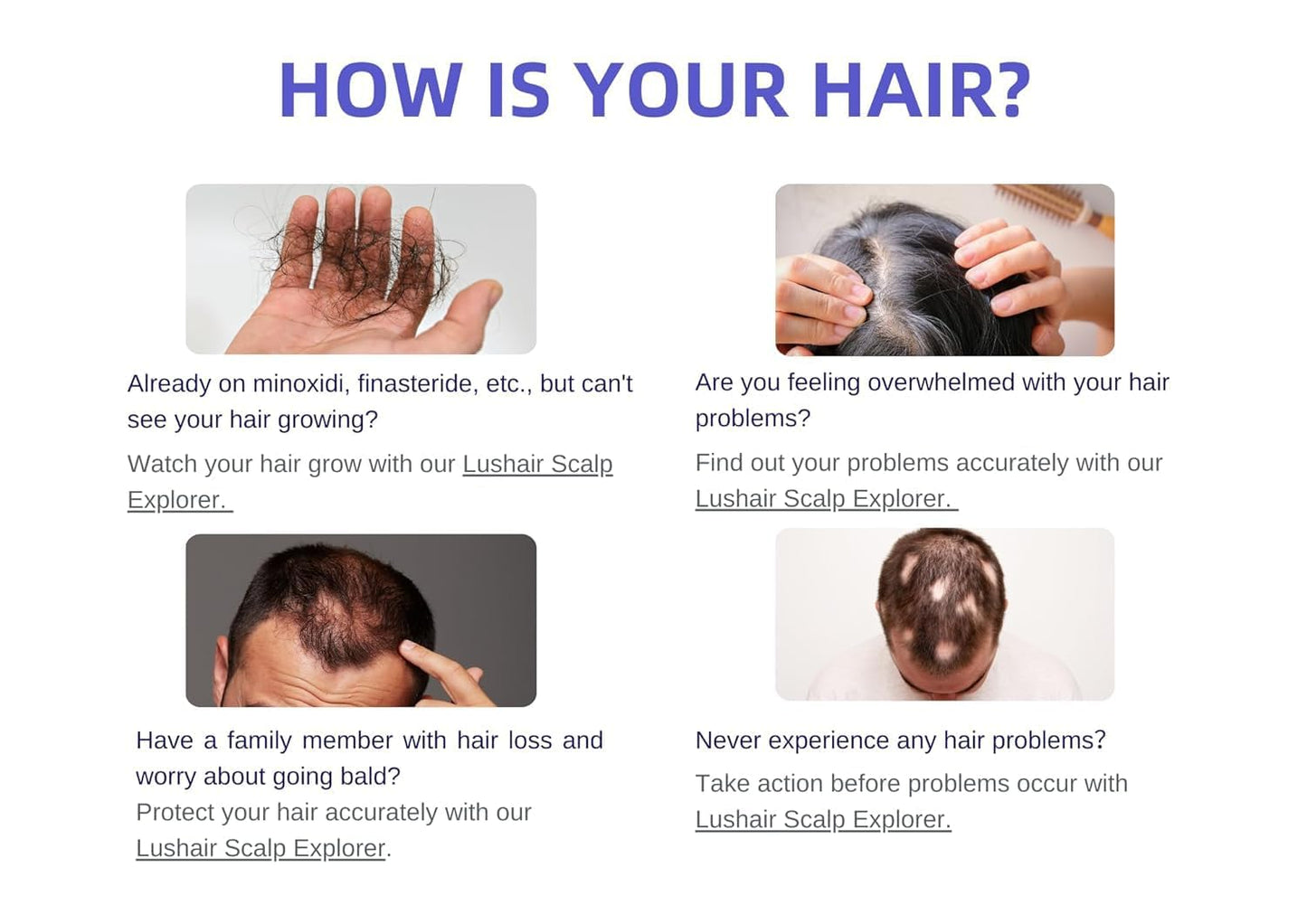 lushair Wireless Hair Analyzer, Hair Follicle Tester, Scalp Microscope, 16-Function Detection, AI Intelligent Analysis Provides Care Plan