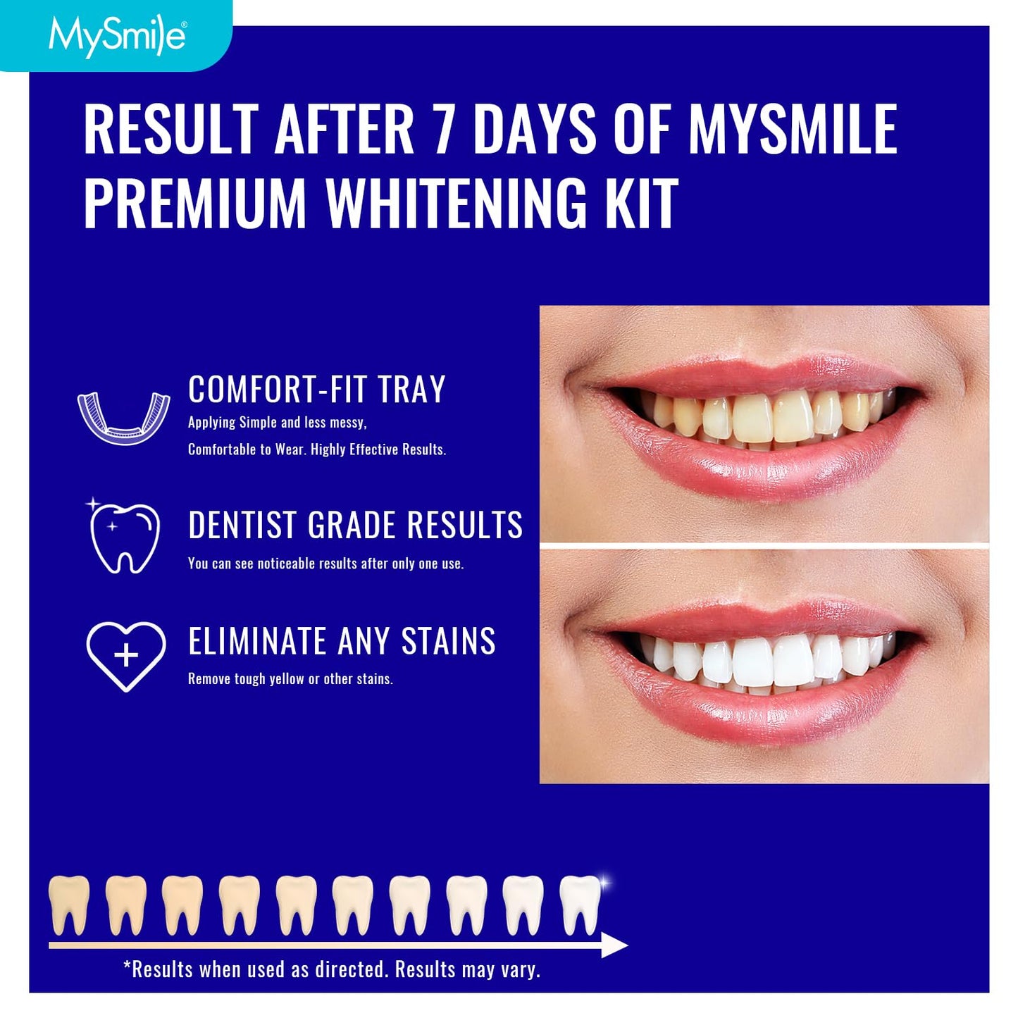 MySmile 7 Treatments Prefilled Teeth Whitening Trays Kit with 12% Hydrogen Peroxide Teeth whitening Gel for Sensitive Teeth, Fast-Result Vegan Teeth Whitener Tooth Stain Remover, Mint Flavor