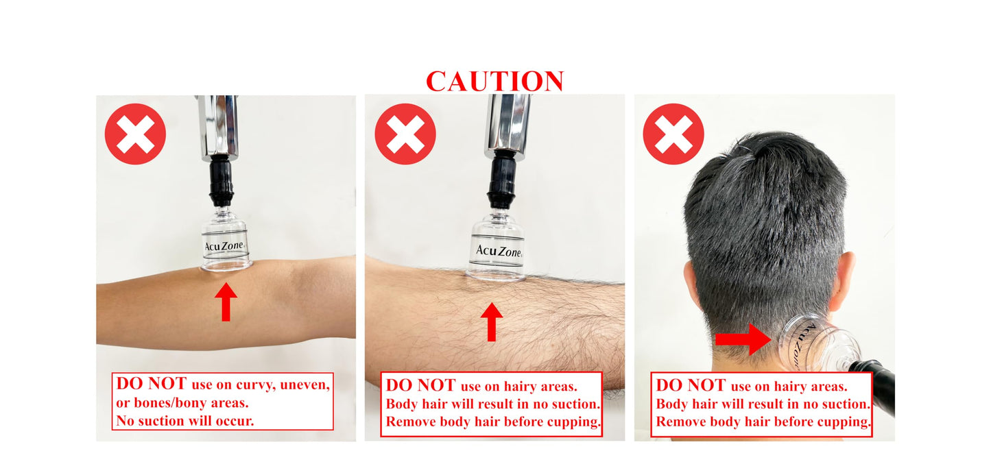 AcuZone Premium 19 Pcs Plastic Cupping Set with Extension Tube