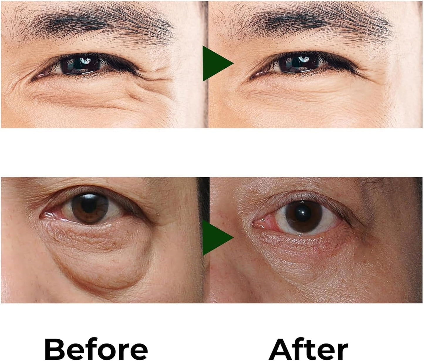 Abera Eye Roller Serum for Men – Eye Bags, Dark Circles & Puffiness Treatment – Mint Essence with Vitamin C & Peptides 0.34 fl oz (2 Boxes) + FREE Abera Men Armpit Roller