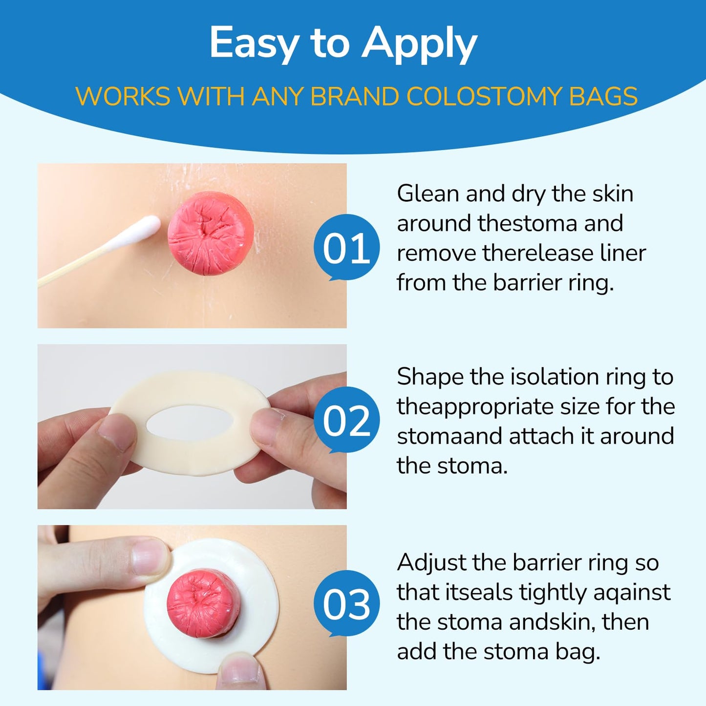 30 PCS Ostomy Barrier Rings, 2 mm Thickness Moldable Ostomy Rings Medical Grade Hydrocolloid Adhesive Barrier Rings Better Seal for Ostomy Bags (3 Box of 30)