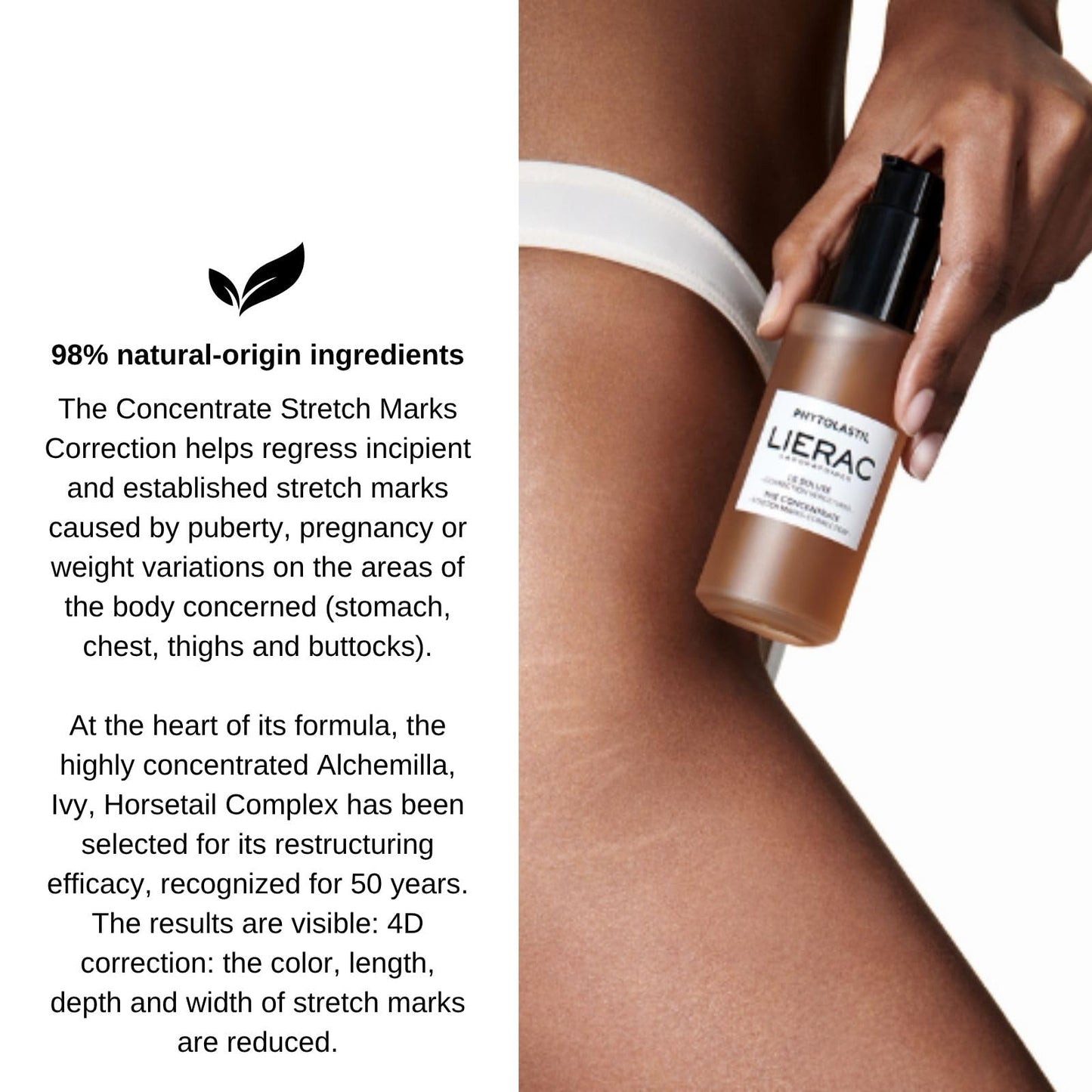 Lierac Phytolastil Stretch Mark Removal Concentrate - Firms Skin, Fades Cellulite, Diminishes Stretch Marks on Breasts, Stomach, Hips, Buttocks & Thighs, Hydrating for All Skin Types - 100ml
