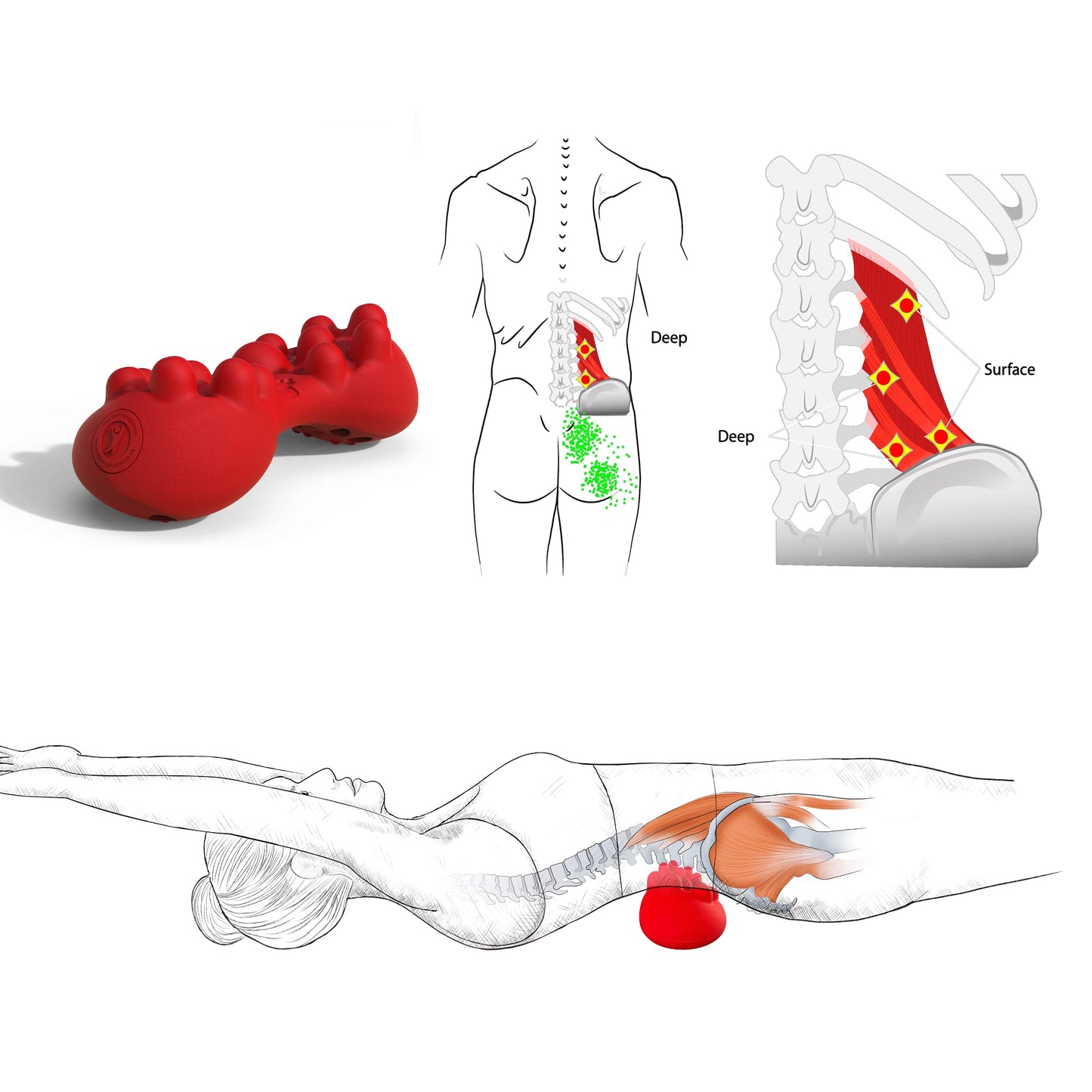 LittleMum Trigger Point Massager for Myofascial Release, Sciatica & Piriformis Syndrome - Relieves Back Knots and Strain Pain