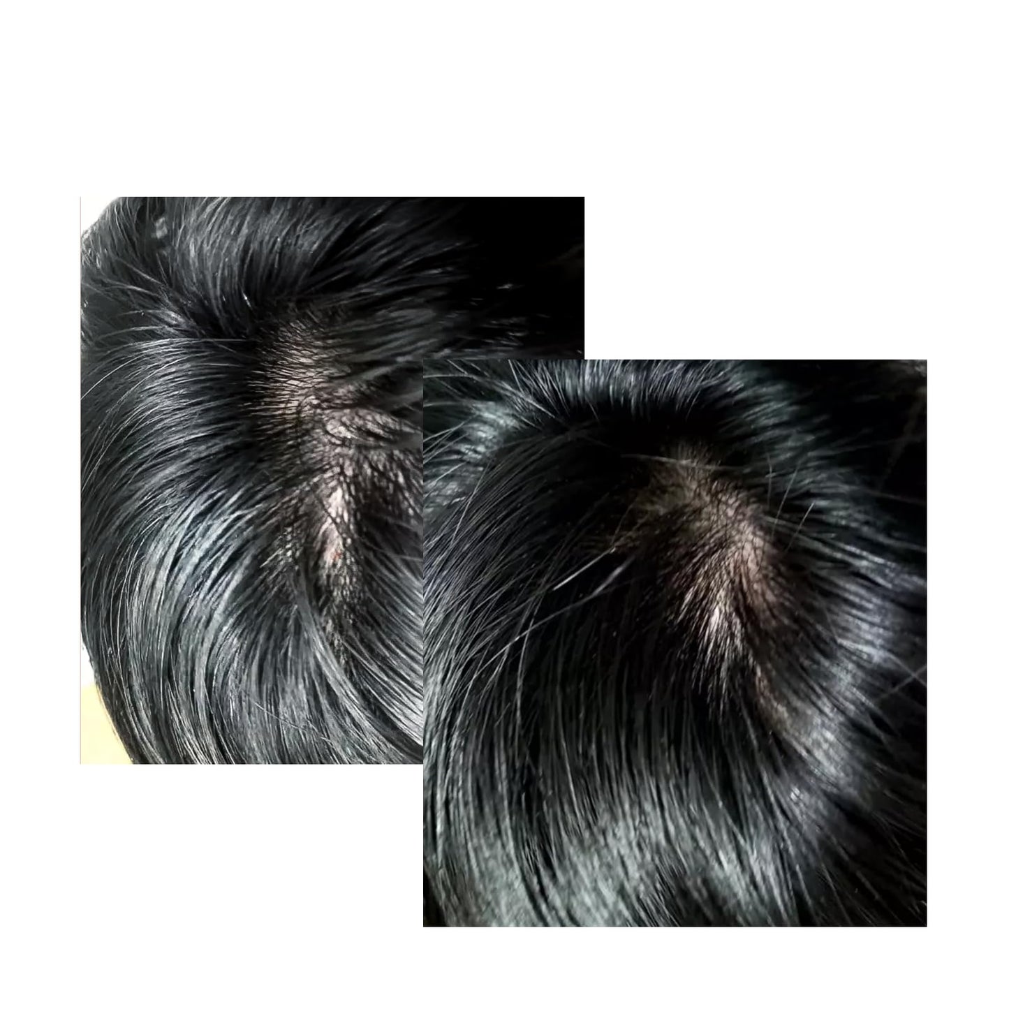 CELONIA NGF 574H Hair Tonic, Korean Primed Bio Stem Cell Hair And Scalp Treatment Serum For Hair Growth And healthy Scalp, Non Greasy Non Oily, Anti Hair Loss, Reduce Flaky Itch And Dry Scalp 50ml