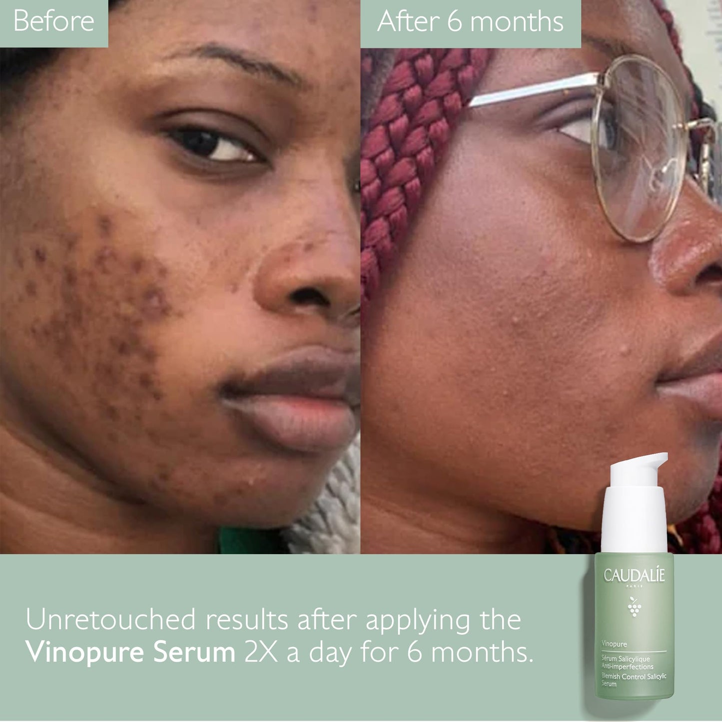 Caudalie Vinopure Skin Perfecting Serum - 30 mL