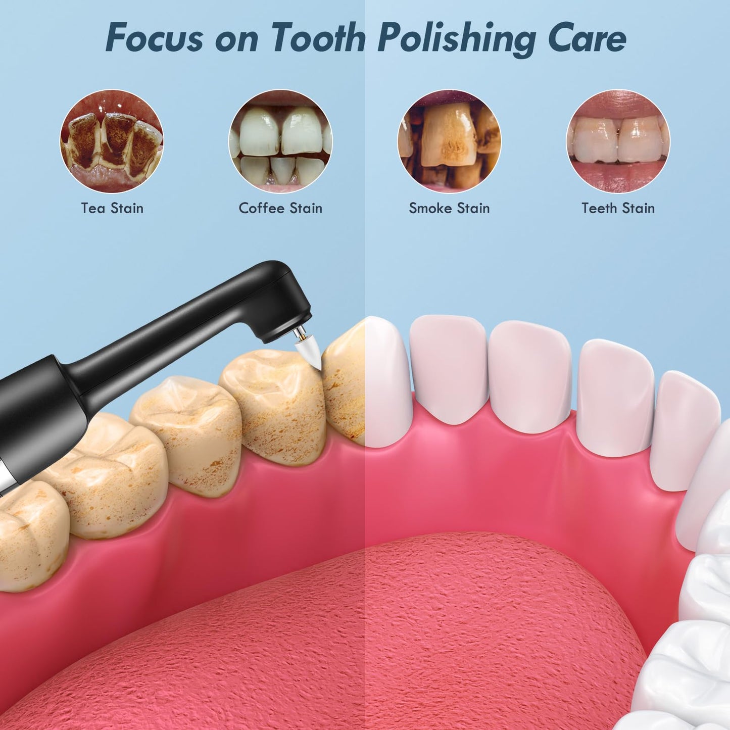 Barlisam Tooth Polisher, Rechargeable Teeth Polisher for Teeth Cleaning, Polishing and Whitening, Electric Dental Polisher Kit with 5 Multifunctional Heads, 5 Speed Modes, and IPX6 Waterproof