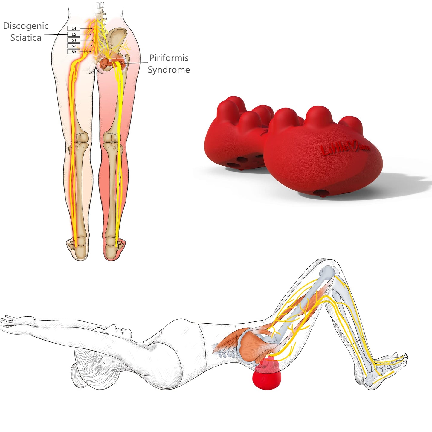 LittleMum Trigger Point Massager for Myofascial Release, Sciatica & Piriformis Syndrome - Relieves Back Knots and Strain Pain