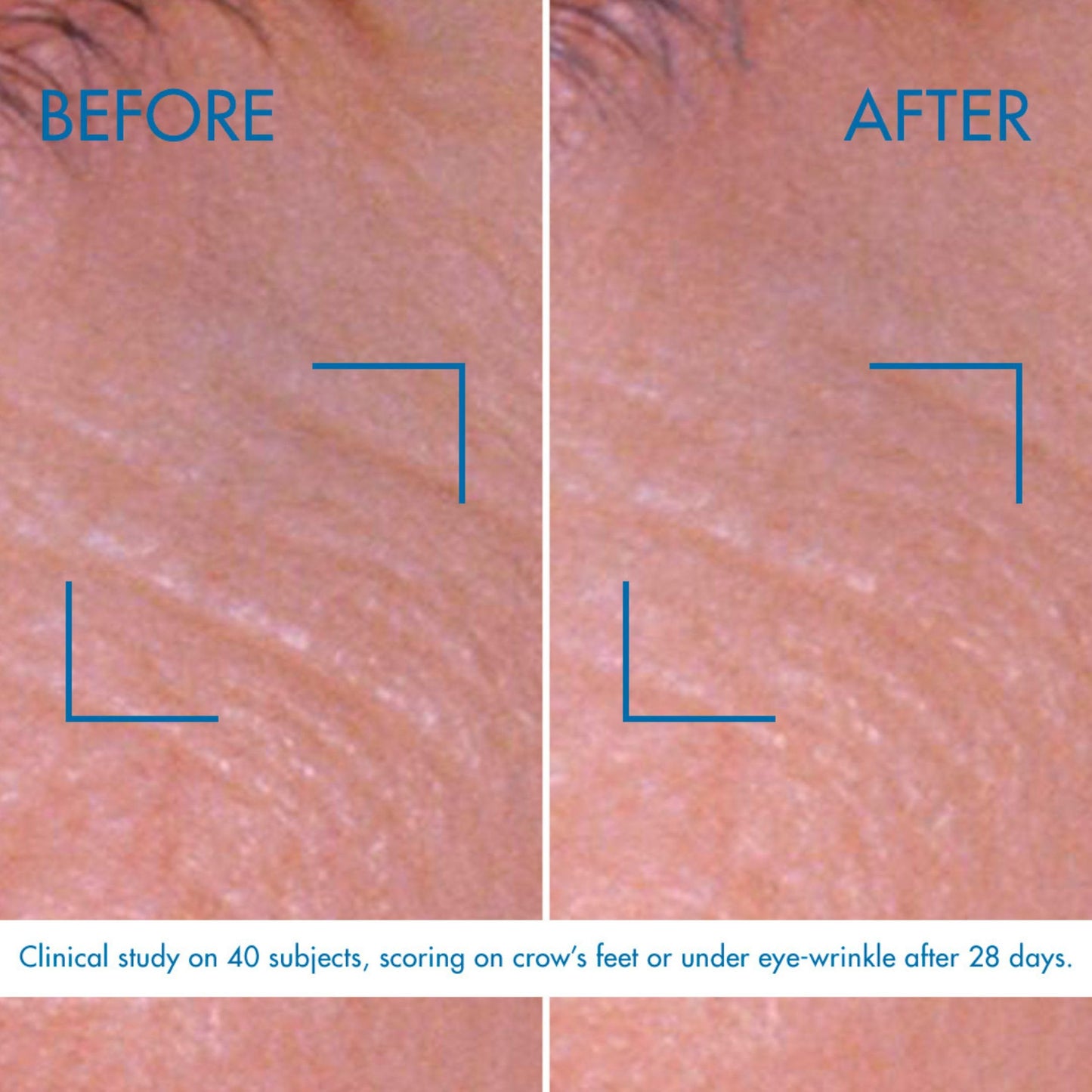 Biotherm Retinol Eye Cream 0.1%, Multi Correct Eye Cream with Peptides and Caffeine, Reduces the Appearance of Dark Circles And Wrinkles, 100% Vegan, 15ml