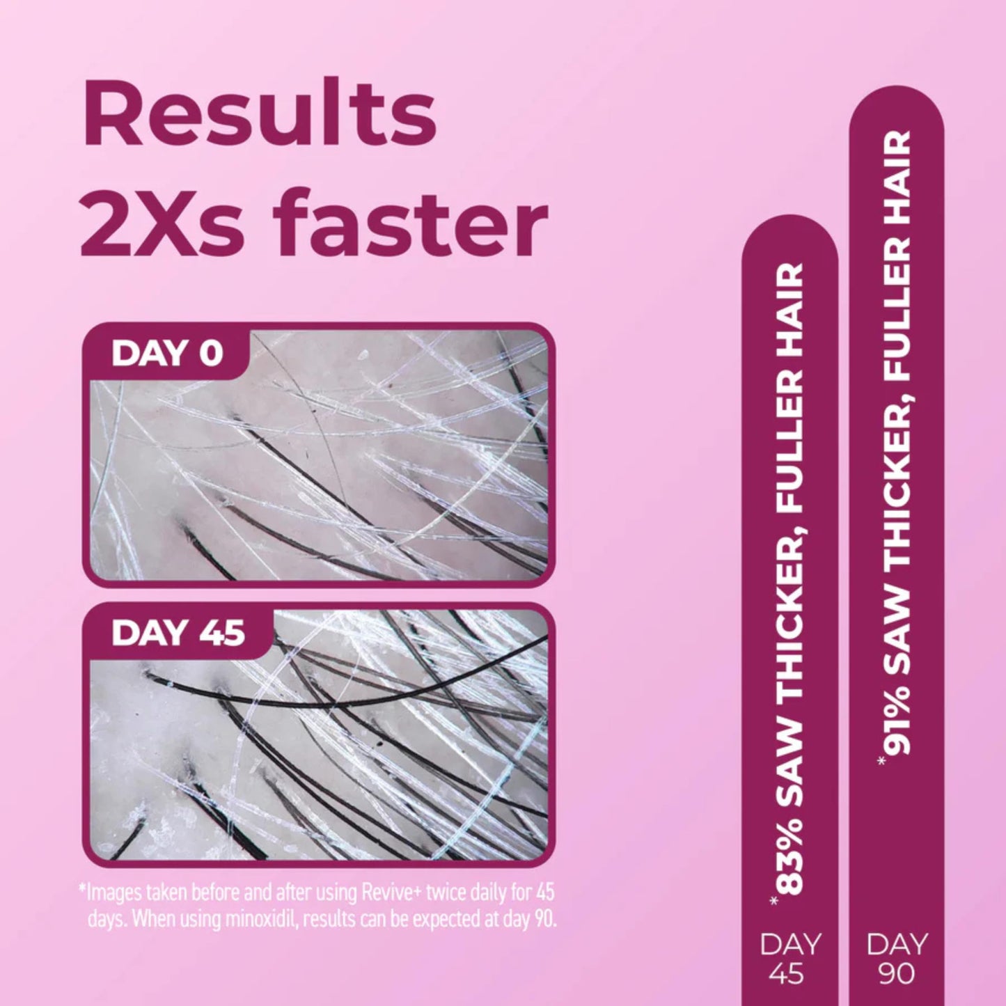 BosleyMD Women's Revive + Densifying Treatment Foam