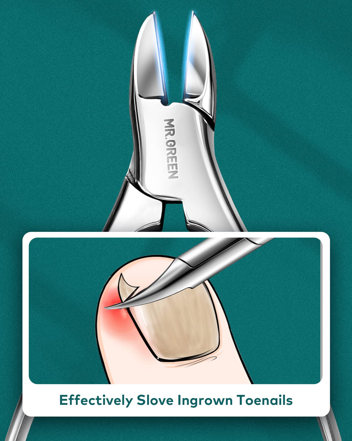 7Pcs Manicure Set,Professional Pedicure Knife Set,Ingrown Toenail Clippers Foot Care Tools, Ingrown Toenail Blade Tool,Foot Repair Sharp Blade Kit,Nail Care Knives Cuticle Remover