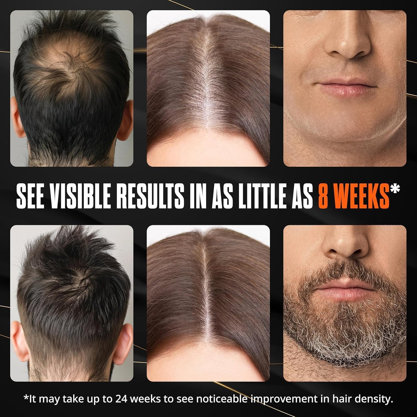 Abera Hair Serum – Nourishing & Thickening with Biotin & Castor Oil