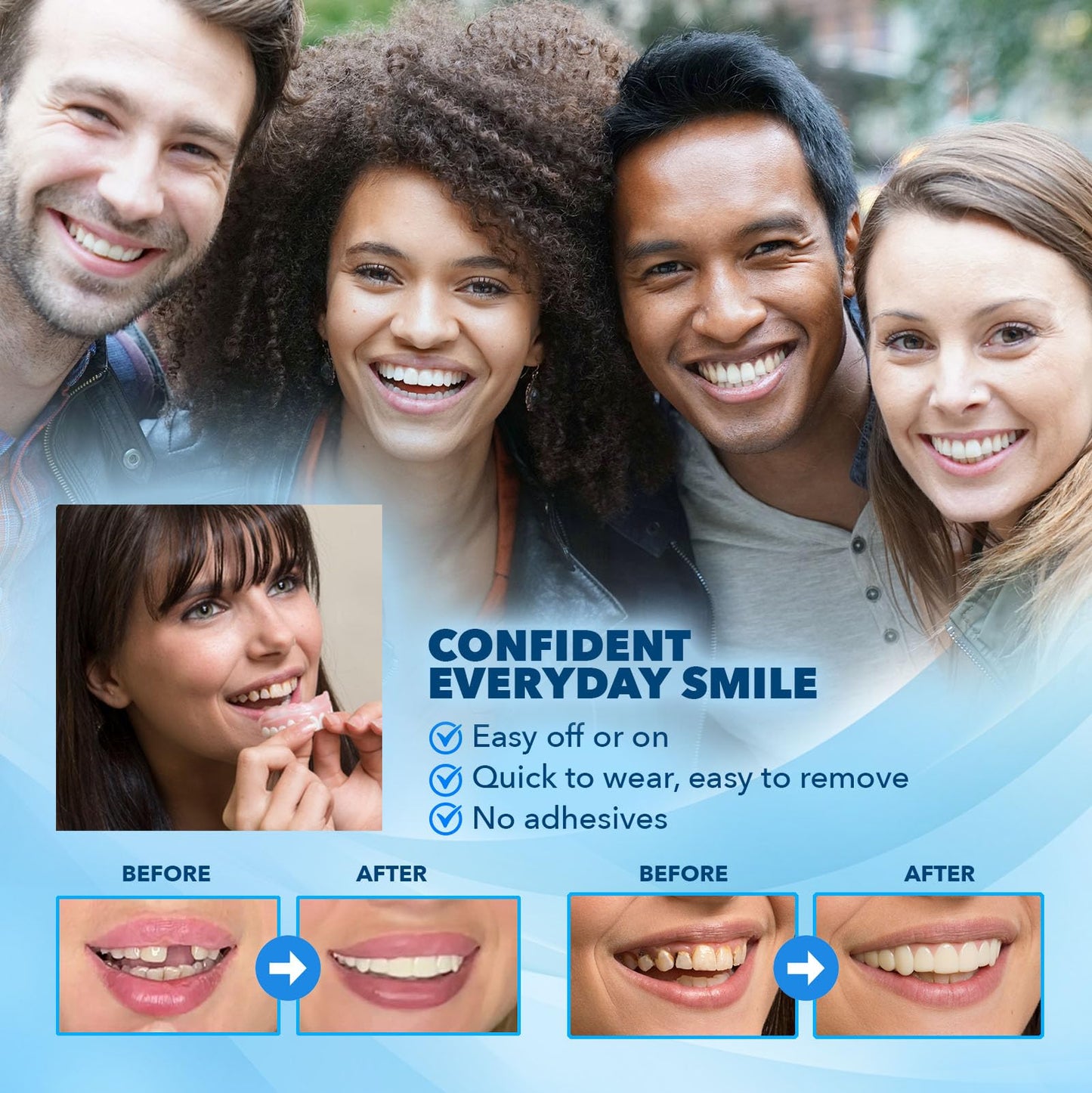 Imako Premium Cosmetic Uppers - 2 Pack - Large, Natural White - DIY Smile Makeover - Made in USA