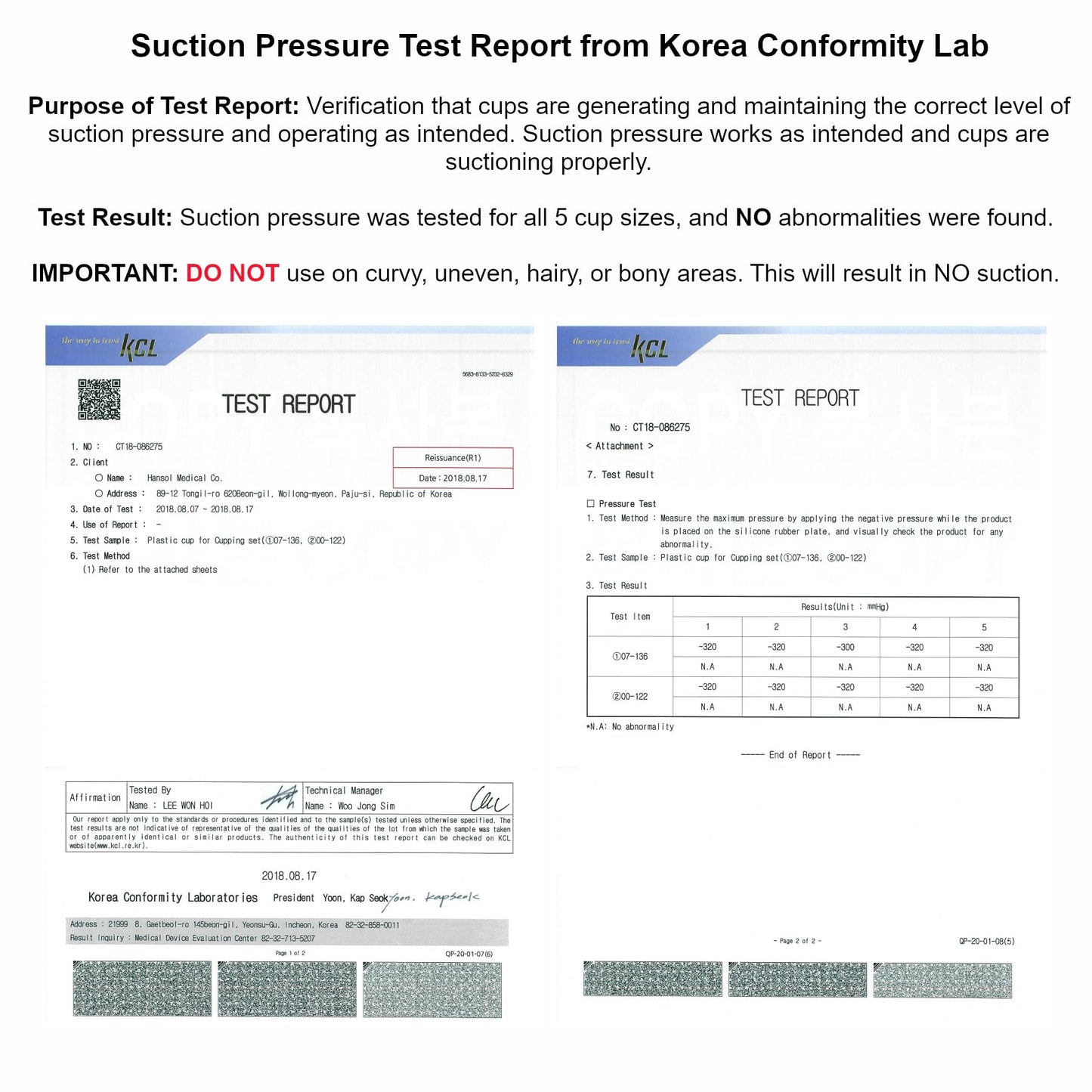 AcuZone Premium 19 Pcs Plastic Cupping Set with Extension Tube