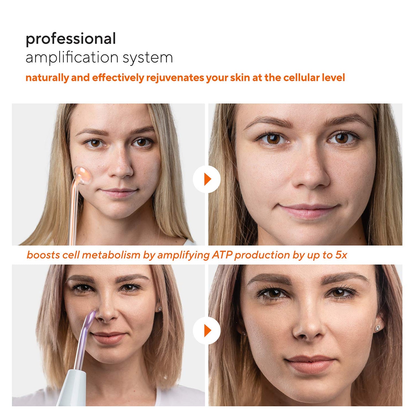 Professional Skin Therapy Wand - NuDerma - Portable Handheld High Frequency Skin Therapy Machine with 6 Neon & Argon Wands - Acne Treatment - Skin Tightening