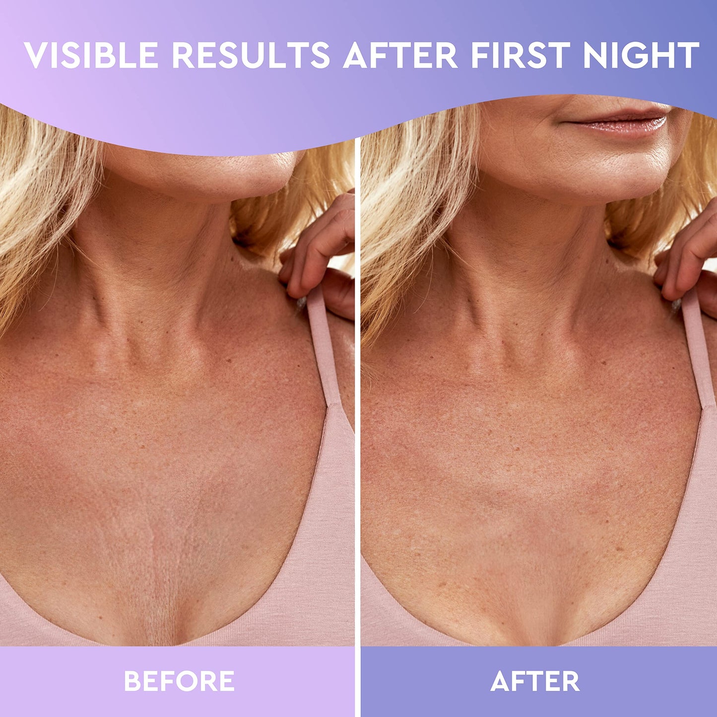 Cleverfy Silicone Chest Wrinkle Pads for Décolleté - 6-Pack of T-Shape Reusable Anti-Wrinkle Patches